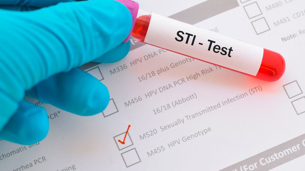 5 der besten Anlaufstellen für STI-Tests in Bergheim – Diskrete Untersuchung auf häufige Infektionen